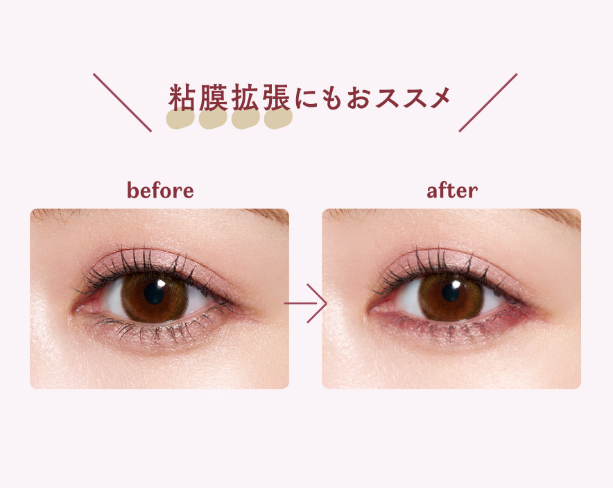 イージーeyeライナーR